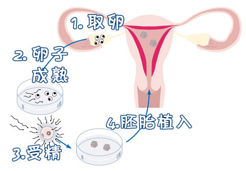 嘉会医疗